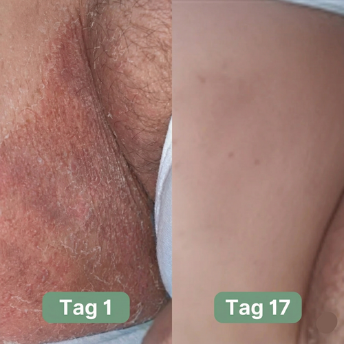 Movelina® SoftCare
