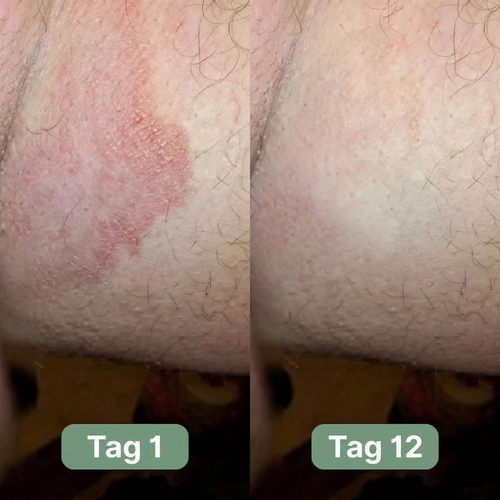 Movelina® SoftCare